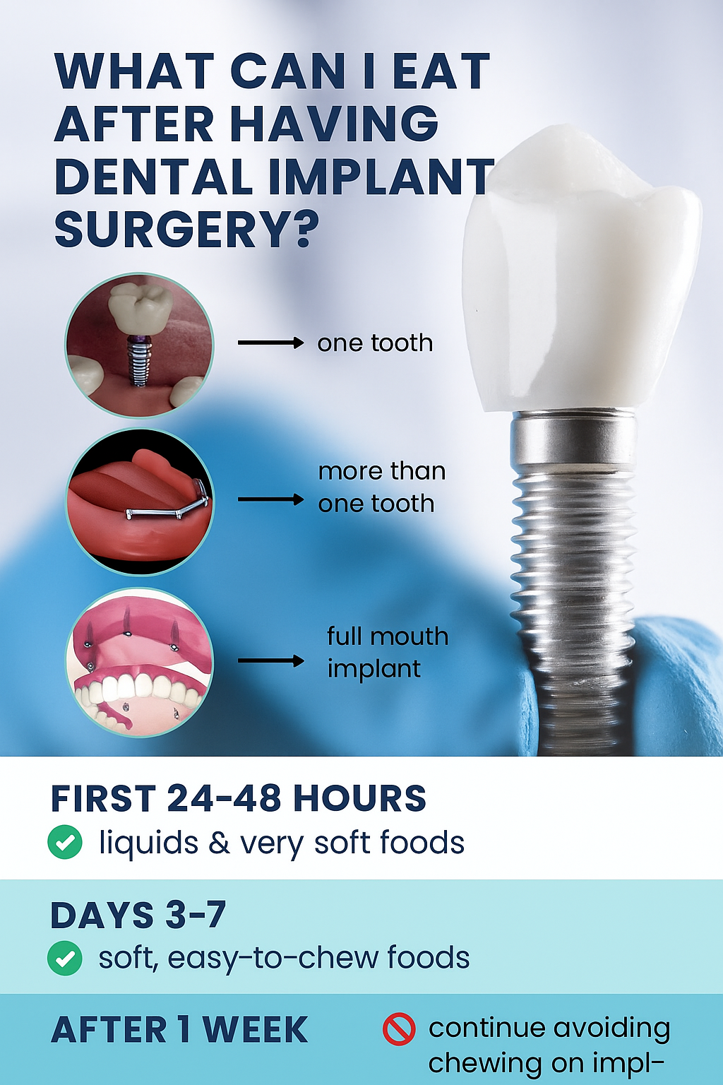What Can I Eat After Having Dental Implant Surgery?